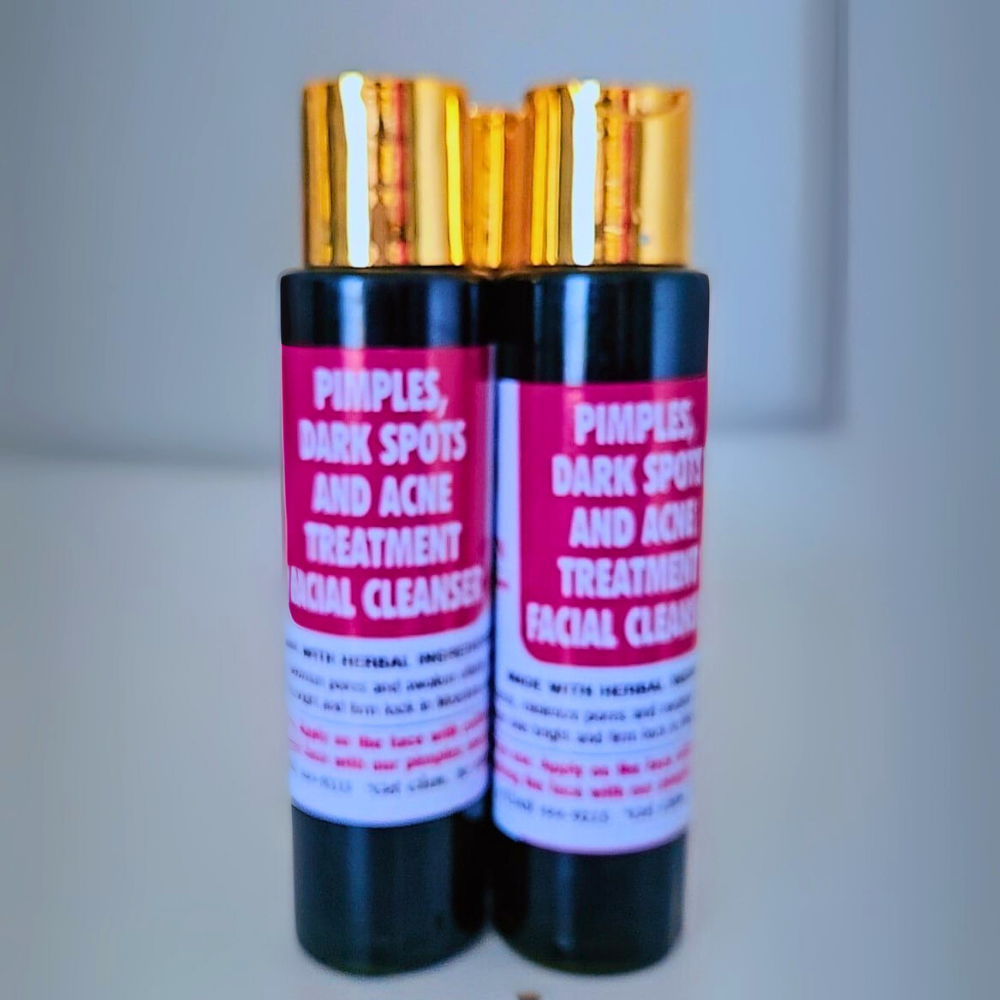 Pimples, Dark Spot and Acne Treatment Face Cleanser